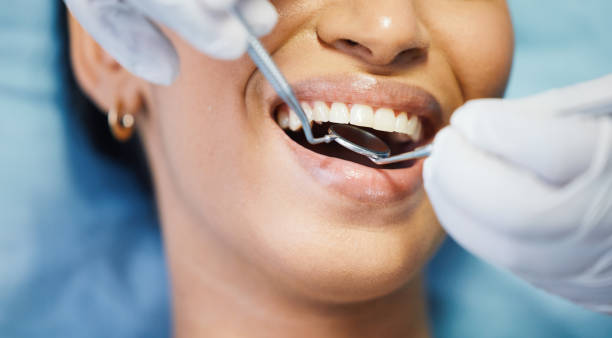 Best Emergency Broken Tooth Repair in Meadow Glade, WA