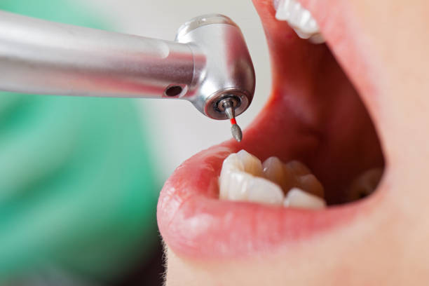 Best After-Hours Emergency Dentist in Meadow Glade, WA